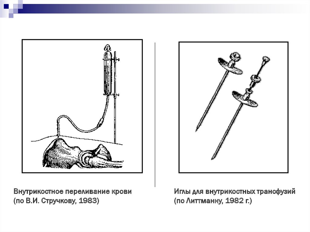 Переливание крови при фурункулезе схема