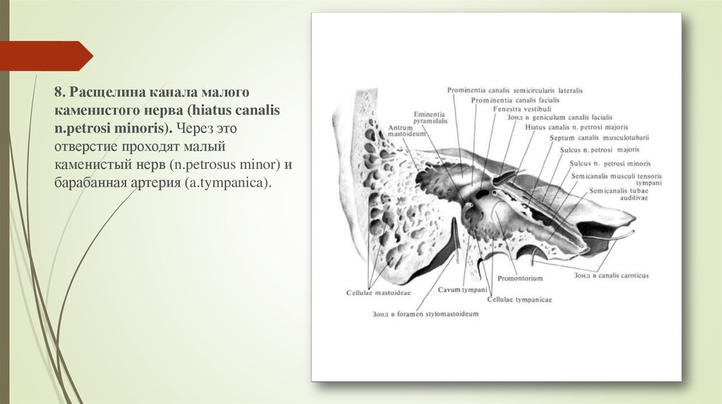 Мал канал. Височная кость расщелина малого Каменистого нерва. Расщелина канала малого Каменистого нерва. Малый Каменистый нерв (n. petrosus Minor). Малый Каменистый нерв в височной кости.