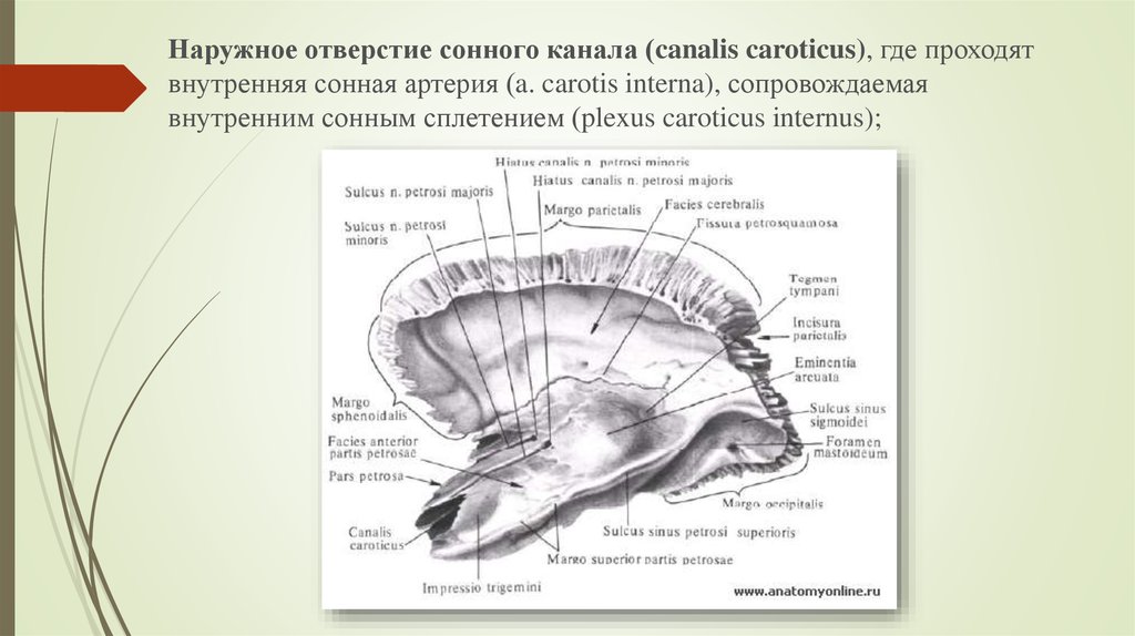 Сонный канал. Наружное и внутреннее отверстие сонного канала. Наружное отверстие сонноготг кагаоа. Наружнее отверстие сонного канала. Внутреннее отверстие сонного канала.
