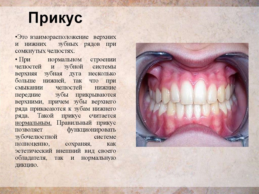 Какой правильный прикус зубов у человека фото