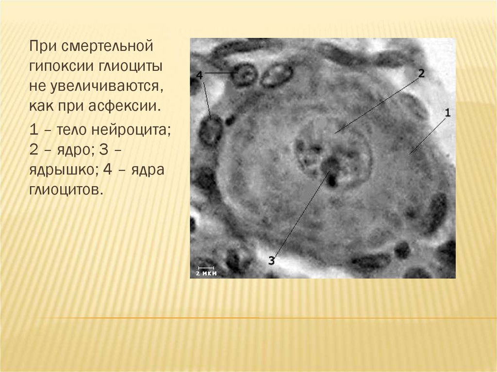 Холодовая травма презентация