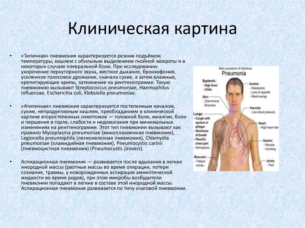 Клиническая картина при пневмонии