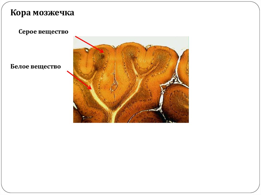 Серое вещество в мозжечке. Мозжечок серое и белое вещество гистология. Распределение серого и белого вещества в мозжечке.
