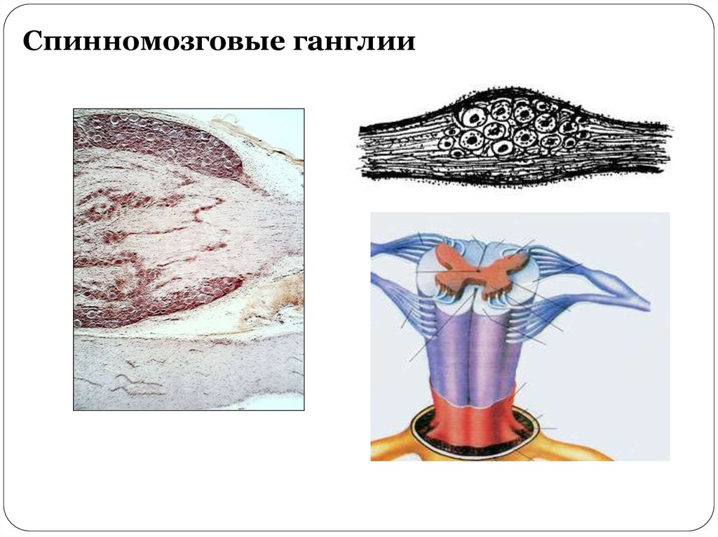 Спинномозговой ганглий рисунок