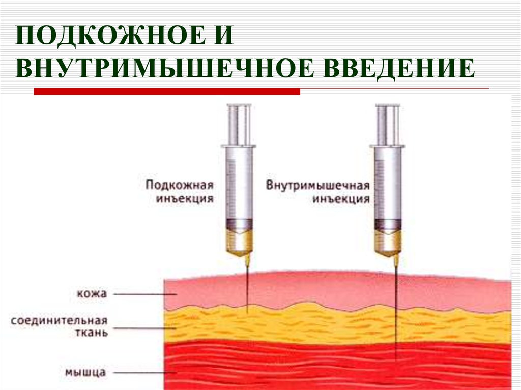 Утром или вечером колоть. Внутримышечная инъекция угол введения иглы. Схема внутримышечных инъекций масляных растворов. Подкожная инъекция глубина введения иглы. Игла для внутримышечных инъекций вводится.