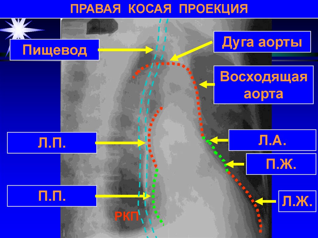 Лучевая диагностика сердечно сосудистой системы презентация