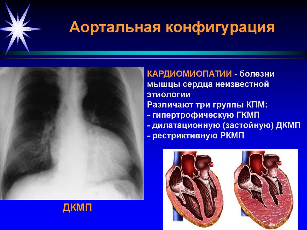 Лучевая диагностика сердечно сосудистой системы презентация