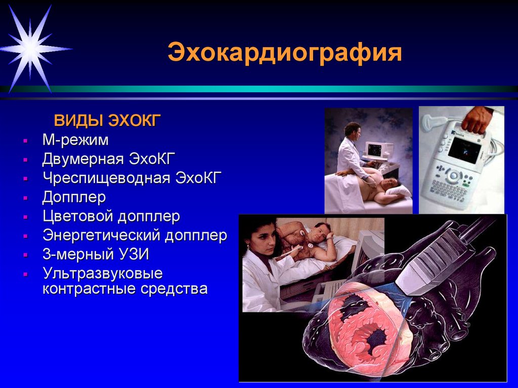 Эхокардиография это. Эхокардиография. Чреспищеводное ЭХОКГ показания. Эхокардиография виды.