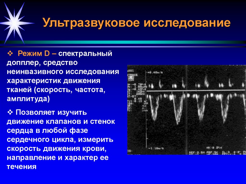 Режим d. Спектральный допплер. Спектральный режим УЗИ. Спектральный допплер УЗИ. Частота ультразвуковых исследований.