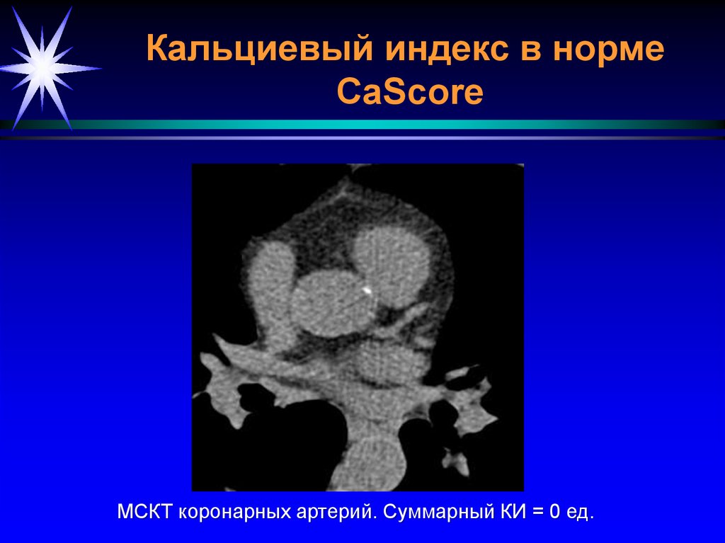 Лучевая диагностика сердечно сосудистой системы презентация