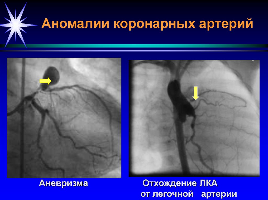 Лучевая диагностика сердечно сосудистой системы презентация