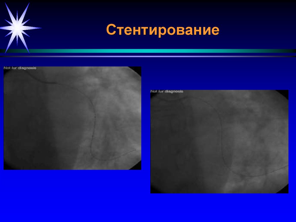 Лучевая диагностика сердечно сосудистой системы презентация