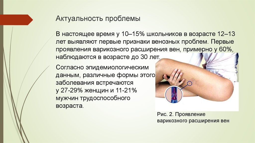 Сестринский уход за пациентами после венэктомии - презентация онлайн