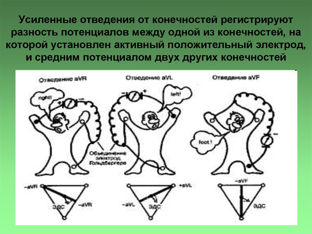 Электроды экг стандартные отведения. Усиленные однополюсные отведения ЭКГ. Стандартные и усиленные отведения ЭКГ. Усиленные отведения ЭКГ AVR. Однополюсные отведения от конечностей.