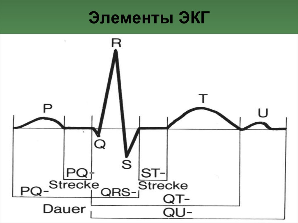 Экг как делают схема