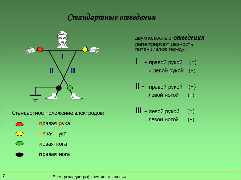 Низкоамплитудные отведения экг