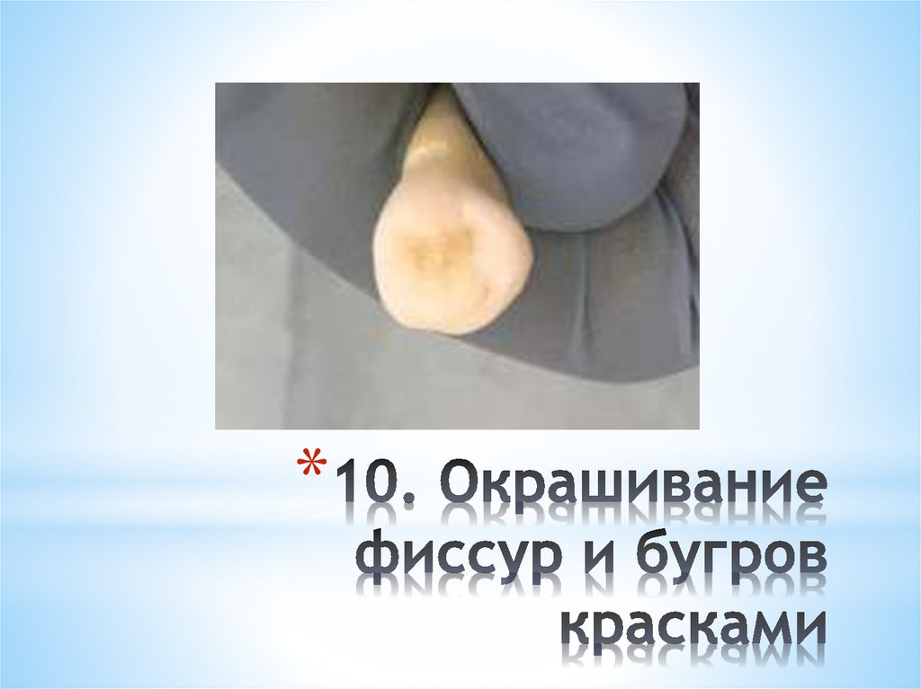 10. Окрашивание фиссур и бугров красками