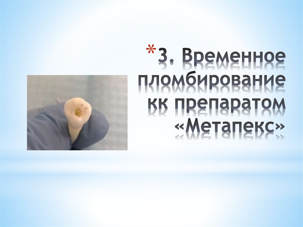 3. Временное пломбирование кк препаратом «Метапекс»