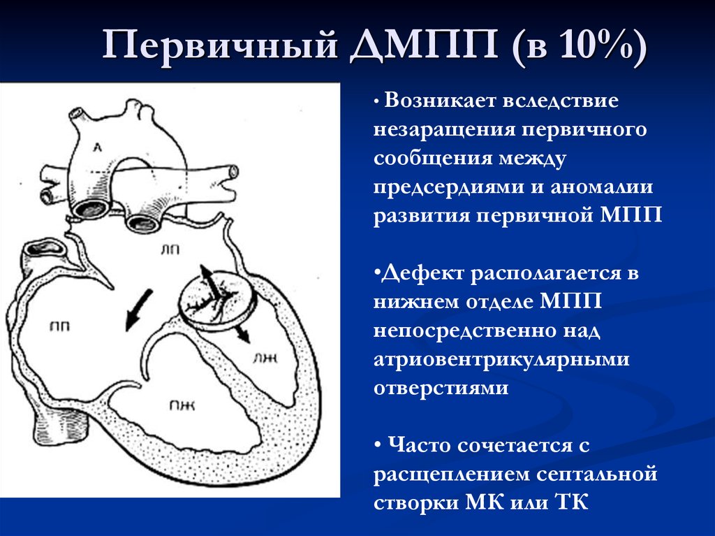 Дмпп аускультативная картина