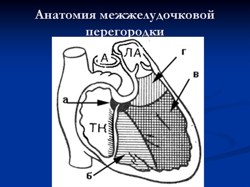 Перегородки сердца. Части межжелудочковой перегородки. Межжелудочковая перегородка анатомия. Строение межжелудочковой перегородки. Строение межпредсердной и межжелудочковой перегородки.