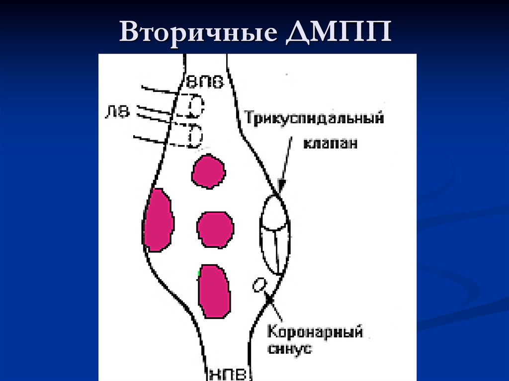 Врожденные пороки развития сердца презентация