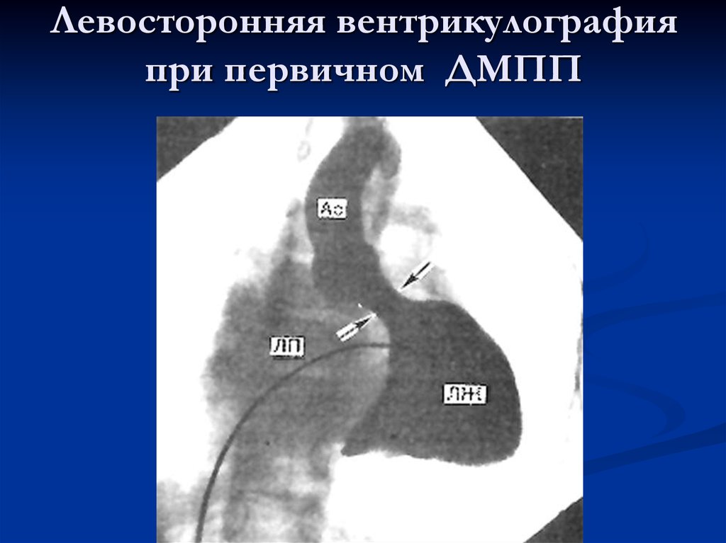 Дмпп у детей презентация