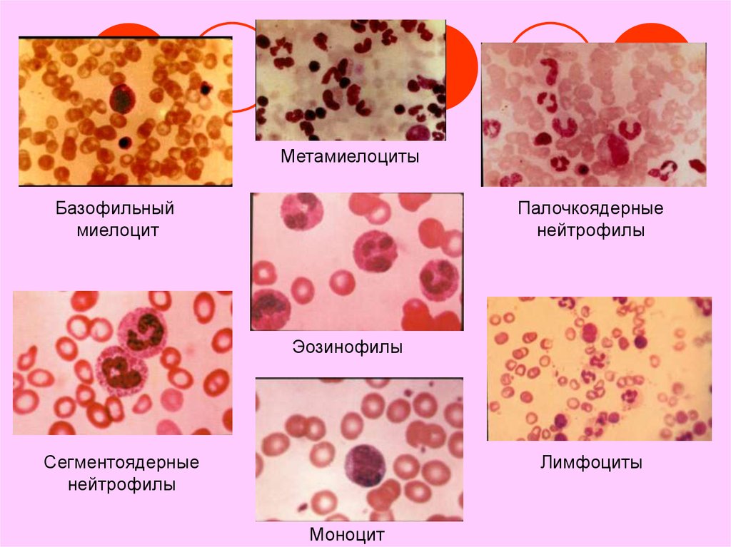 Палочкоядерные нейтрофилы картинки