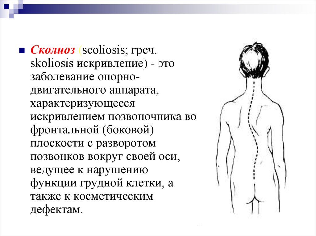 В каких плоскостях бывает ротация сколиоза