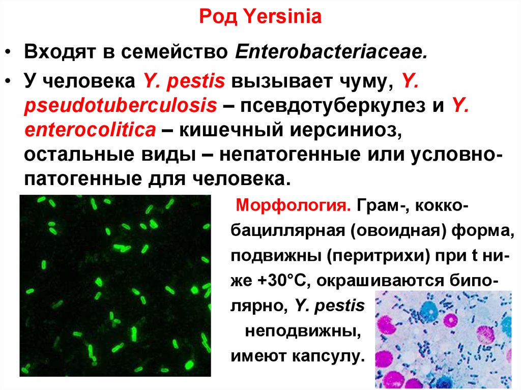 Кишечный иерсиниоз презентация