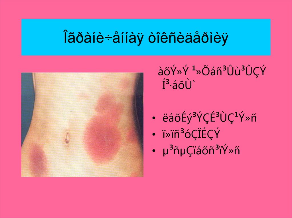 Îãðàíè÷åííàÿ òîêñèäåðìèÿ