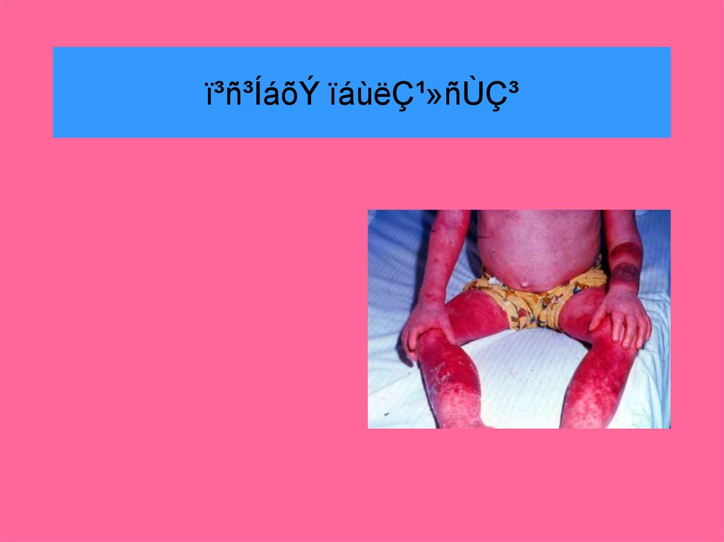 ï³ñ³ÍáõÝ ïáùëÇ¹»ñÙÇ³