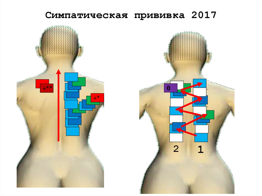 Симпатическая прививка 2017