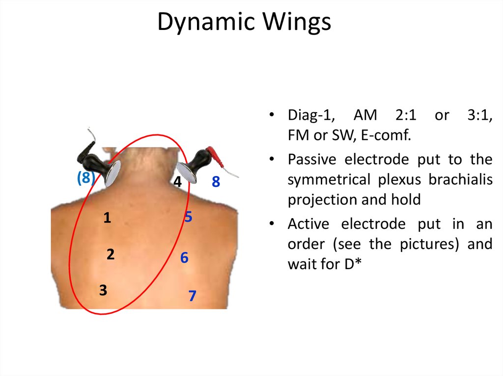 Dynamic Wings