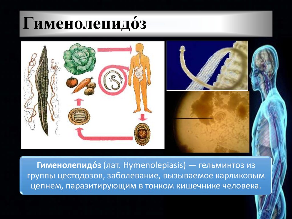 Схема лечения гименолепидоза