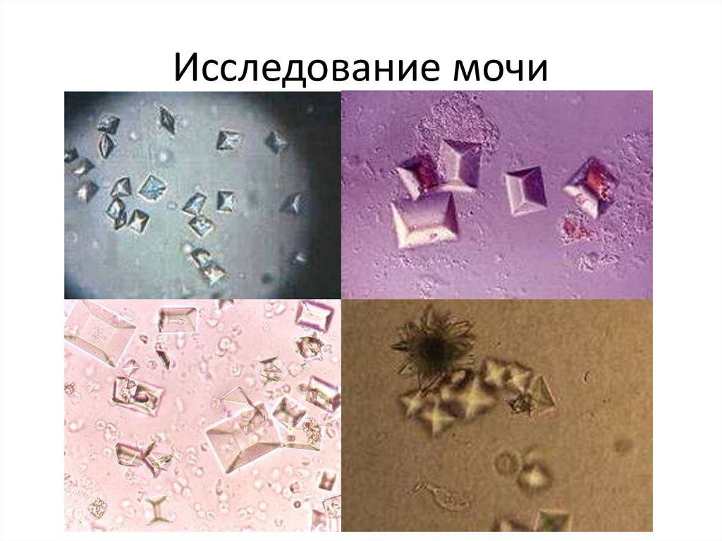 Исследование мочи