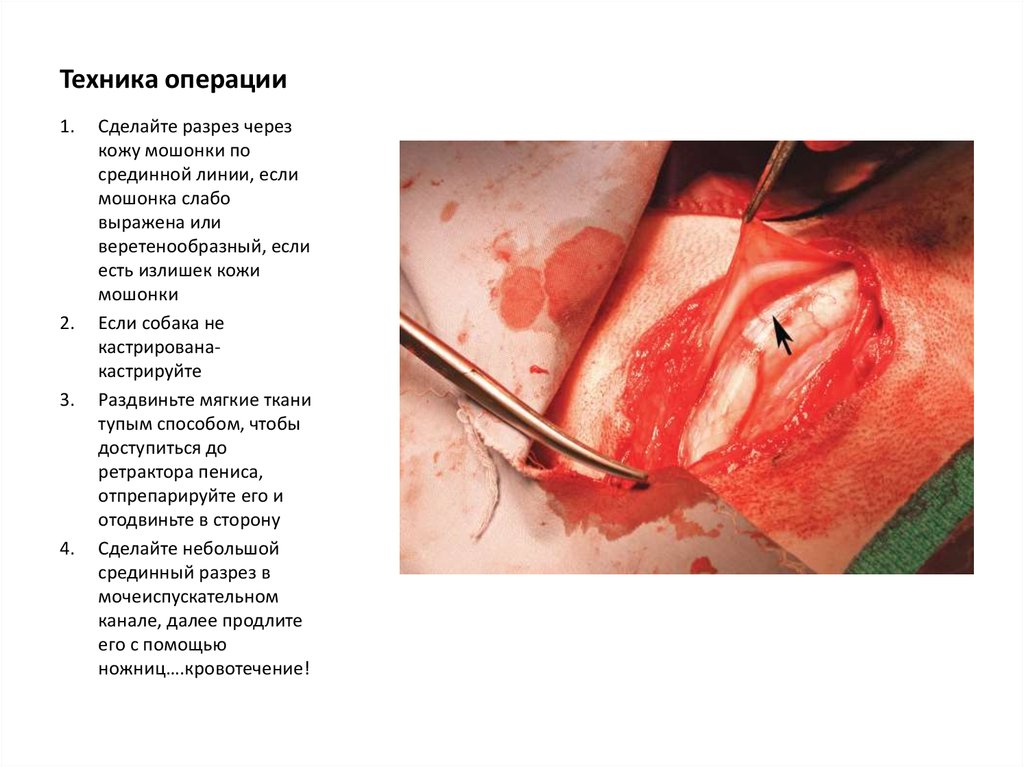 Техника операции