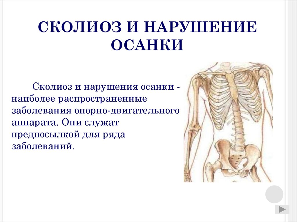 Анатомия и физиология опорно двигательного аппарата презентация