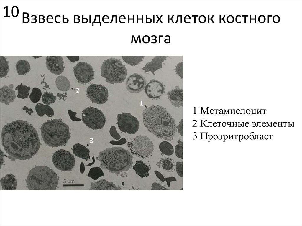 Клеточные элементы представлены. Клетки костного мозга. Взвесь клеток это. Выделение клетки. Костные клетки.