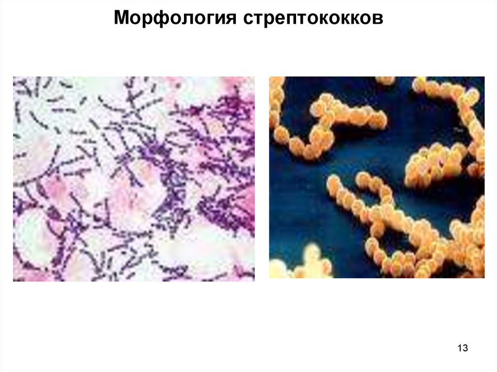 Тест стрептококк группы а. Streptococcus pyogenes морфология. Стрептококки микробиология морфология. Бета гемолитический стрептококк морфология. Стрептококк ангинозус.
