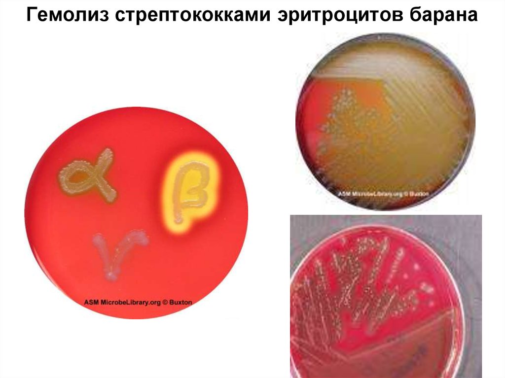 Гемолиз эритроцитов. Гемолиз эритроцитов барана. Гемолизины стрептококков. Гемолиз эритроцитов реакция.