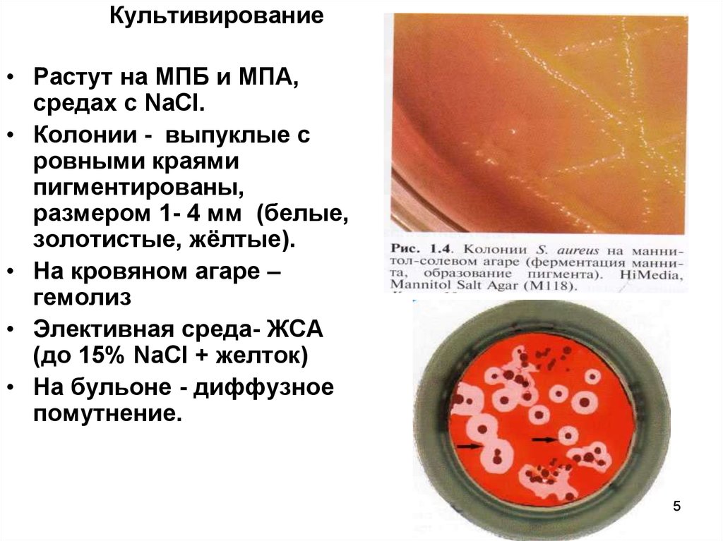 Кал на возбудителей кишечных инфекций