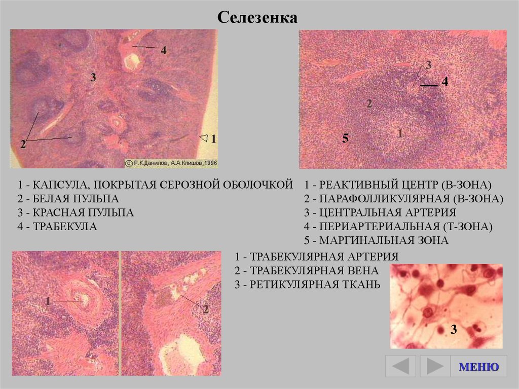 Реактивная гиперплазия лимфоузла. Селезенка гистология препарат. Красная пульпа селезенки гистология препарат. Селезенка препарат гистология под микроскопом. Зскдлезенка гистология препараты.
