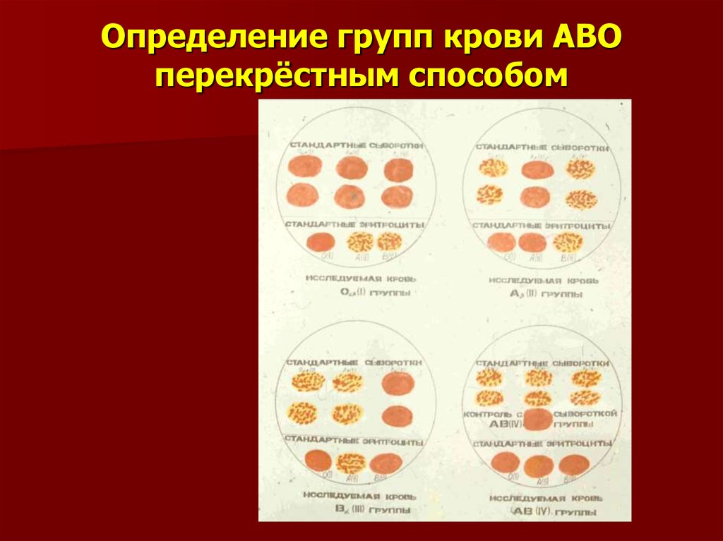 Метод перекрестные группы. Перекрестный способ определения группы крови. Перекрестный метод определения группы крови по системе АВО это. Схема определения групп крови по системе АВО. Определение группы крови цоликлонами перекрестным методом.