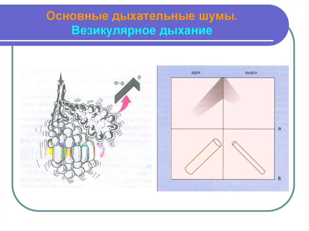 Перкуторный звук везикулярный