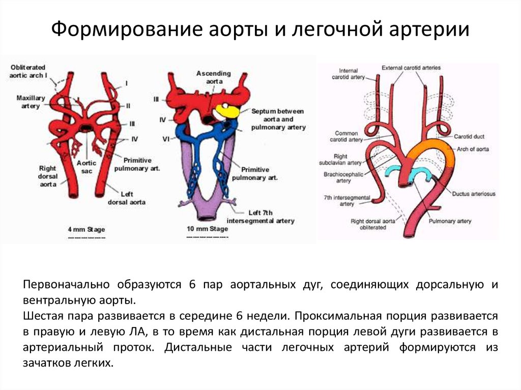 Рассмотрите схему сосудов дуги аорты сделайте к рисунку необходимые обозначения