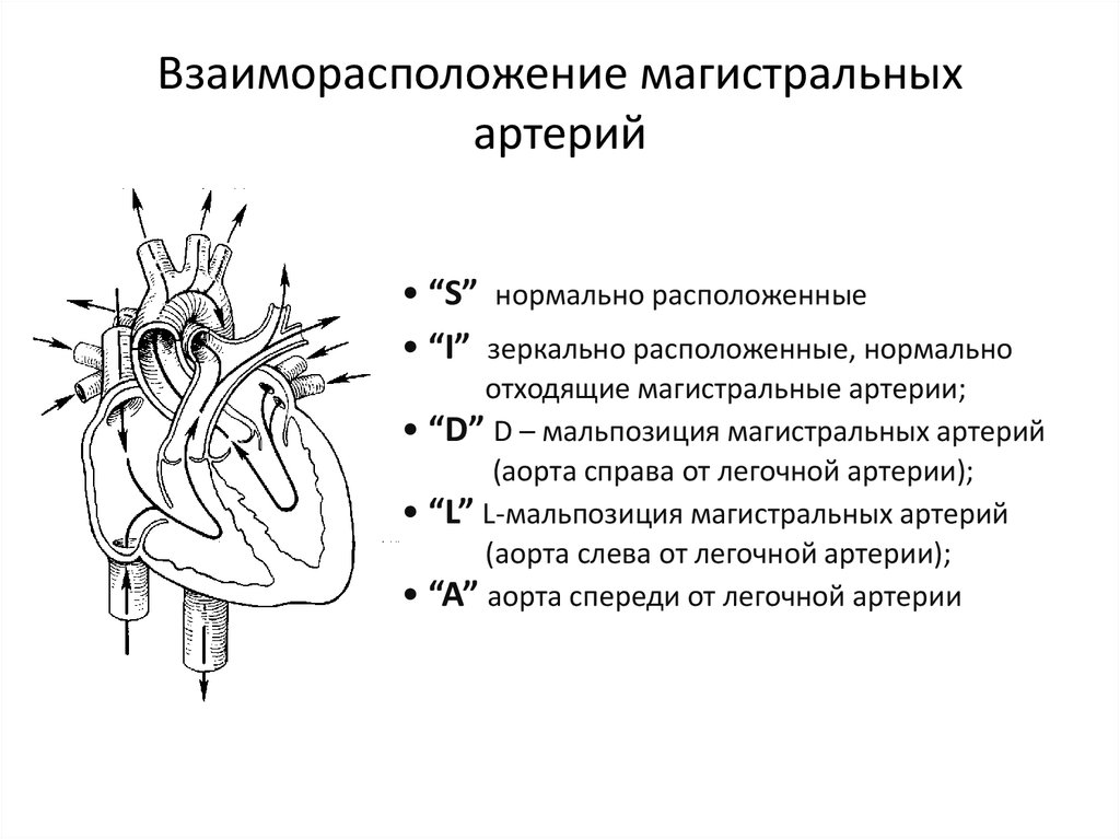 Магистральные сосуды это. Строение магистральных сосудов. Магистральные артерии примеры. Мальпозиция магистральных сосудов. Схема магистральных сосудов.