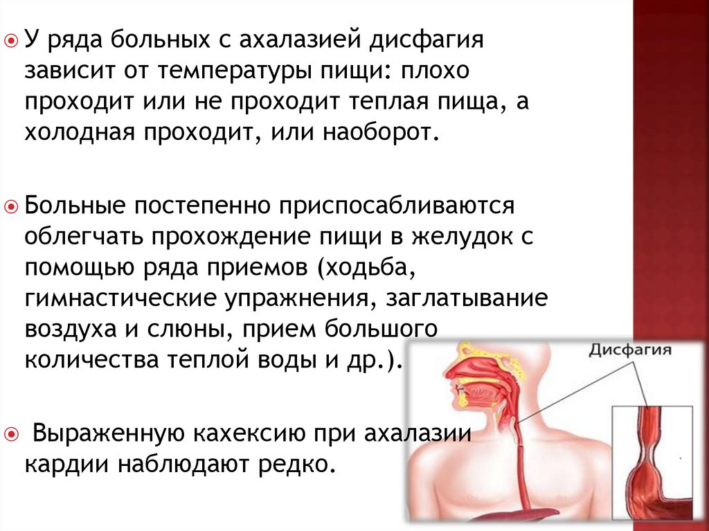 Дисфагия пищевода