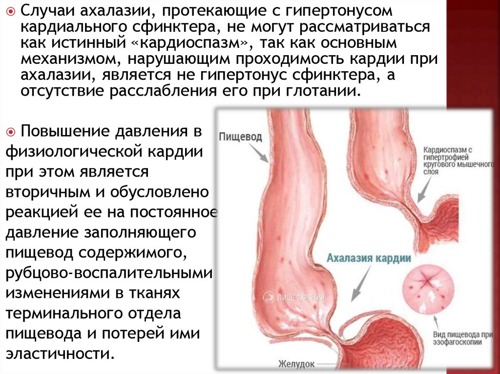 Пищевода реферат