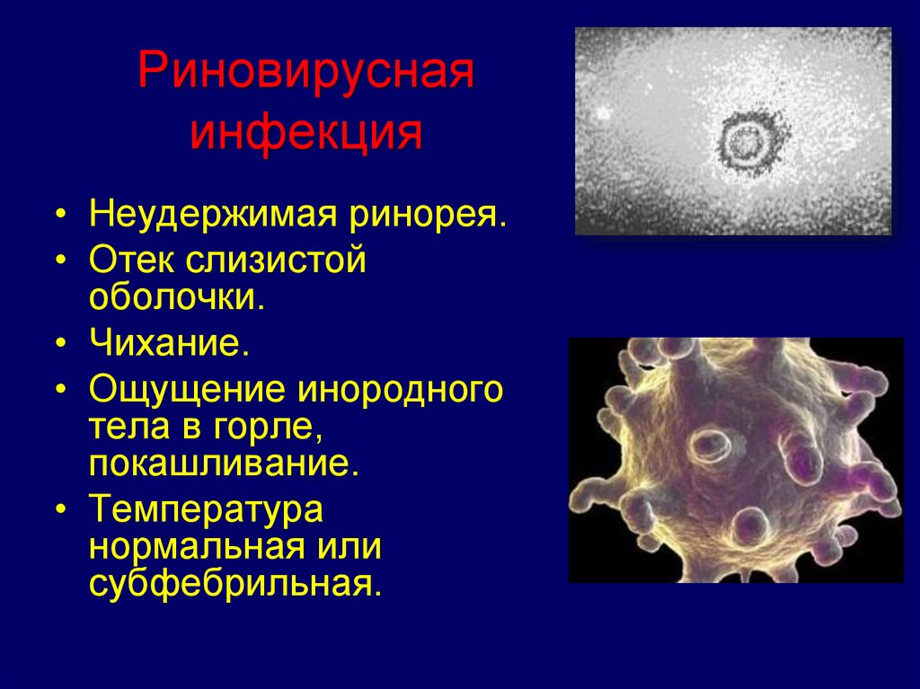 Орви презентация инфекционные болезни