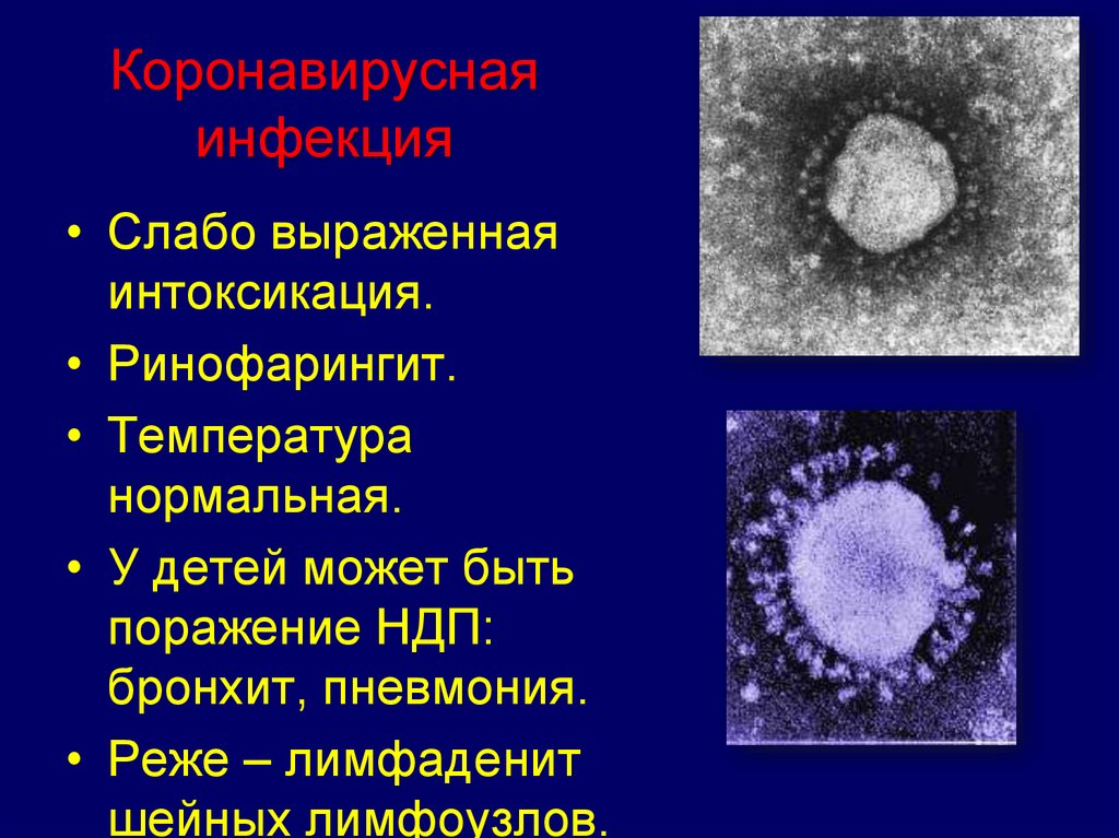 Возбудителем коронавирусной инфекции является вирус семейства. Коронавирусная инфекция. Презентация на тему коронавирусная инфекция. Новая коронавирусная инфекция презентация. Коронавирусная инфекция у детей презентация.